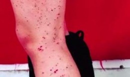 血点 在线观看,揭秘神秘血案背后的惊悚真相